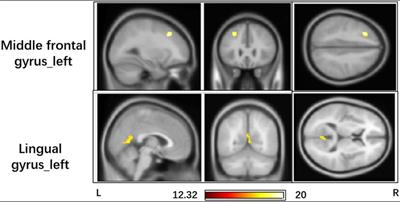 Flight training changes the brain functional pattern in cadets